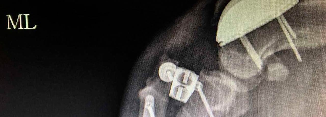 Especialistas de UVM colocan prótesis ortopédicas a perros